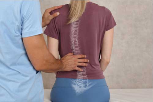 Picture with a chiropractician and a patient that has scoliosis